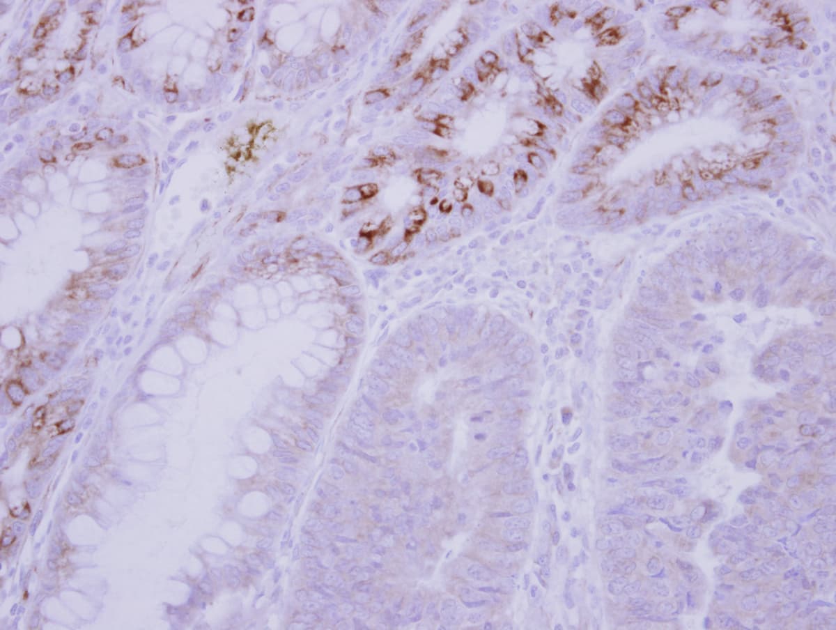 GCKR Antibody