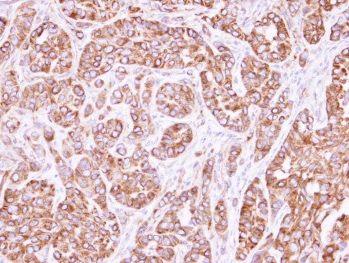 ACTL8 Antibody (aa156-366)