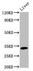 Polyclonal Rabbit anti-Human Rhodanese / TST Antibody (IHC, WB)