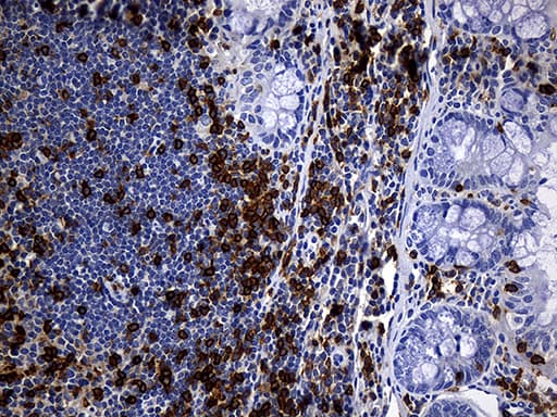 CD5 Antibody (clone UMAB9, Carrier-free)