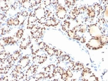 NKX2-1 / Thyroid-Specific TF Antibody (clone NX2.1/690)