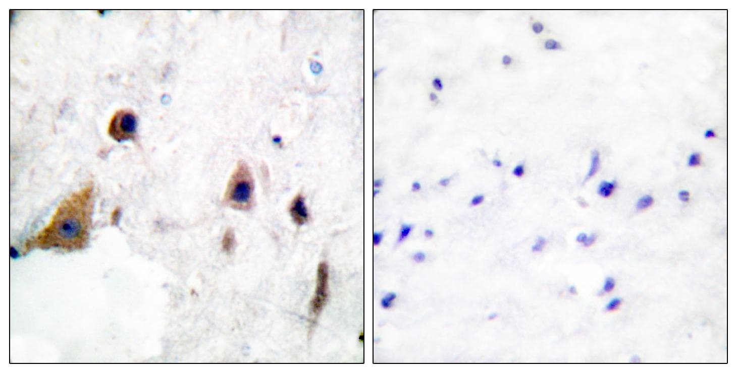 Polyclonal Rabbit anti-Human PPP1R1B / DARPP-32 Antibody (phospho-Thr75, IHC, WB)