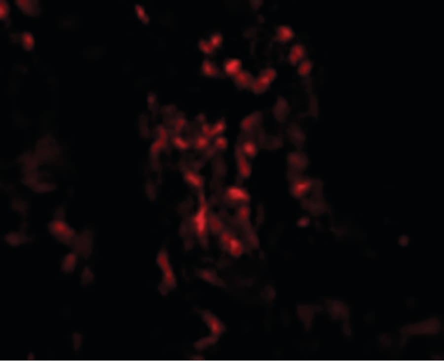 TNFAIP3 / A20 Antibody