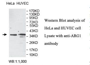 ARG1 / Arginase 1 Antibody (aa2-189)