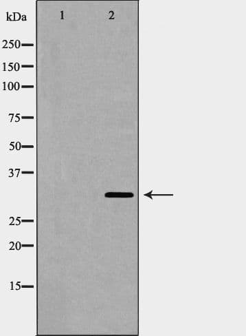 BAG1 / BAG-1 Antibody