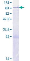 Human CHDH / CHD Protein (Recombinant GST)