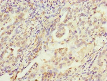 MRPS22 Antibody