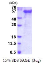 Human FST / Follistatin Protein (Recombinant His)