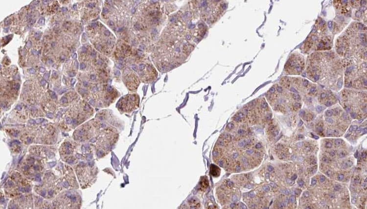 DHX58 / LGP2 Antibody