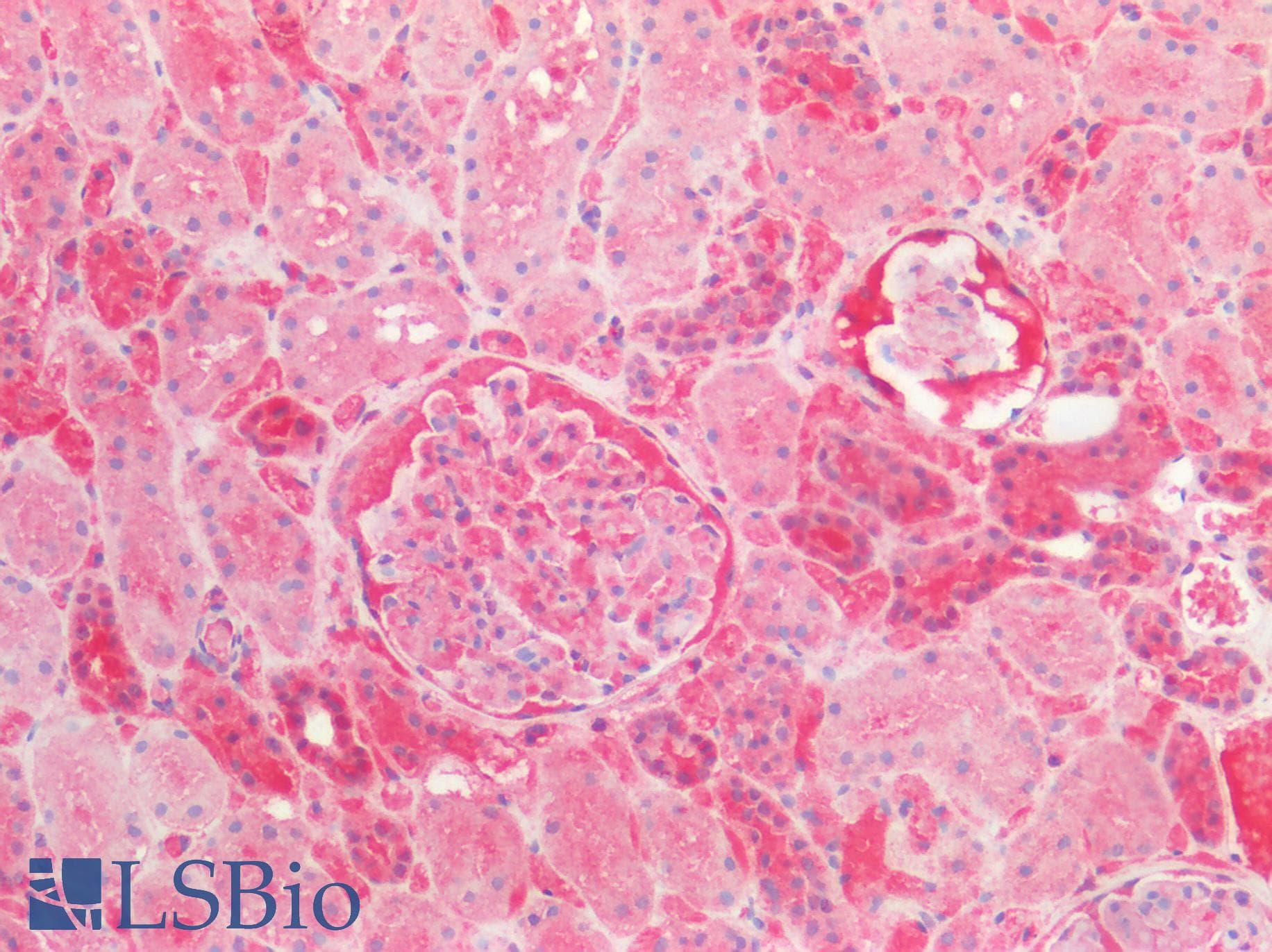 IHC-plus™ CSNK1A1 / CK1 Alpha Antibody (aa100-200)