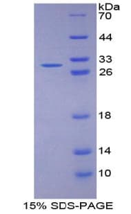 Rat MAP1L / MAP1A Protein (Recombinant His-GST, N-terminus)