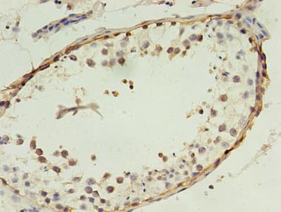 MAGEA4 Antibody