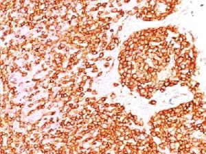 CD45RB Antibody (clone DF-B1, Ready-to-Use)
