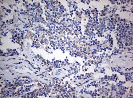 Monoclonal Mouse anti-Human CD4 Antibody (clone OTI5C2, IHC, WB)