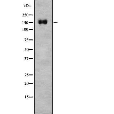 SLIT2 Antibody