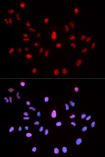 ATM Antibody (phospho-Ser1981)
