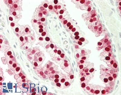 IHC-plus™ Polyclonal Rabbit anti-Human TRAF4 Antibody (aa420-470, IHC)