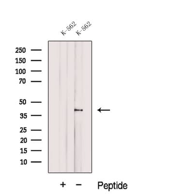 Polyclonal Rabbit anti-Human DUSP11 Antibody (WB)