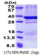 Human TPGS2 / C18orf10 Protein (Recombinant His)