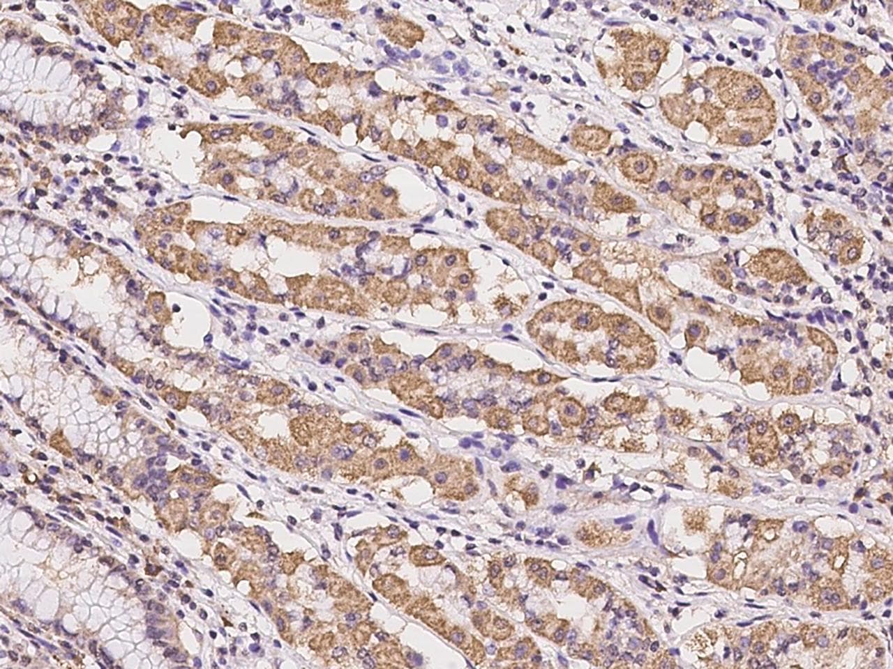 LRIG2 Antibody