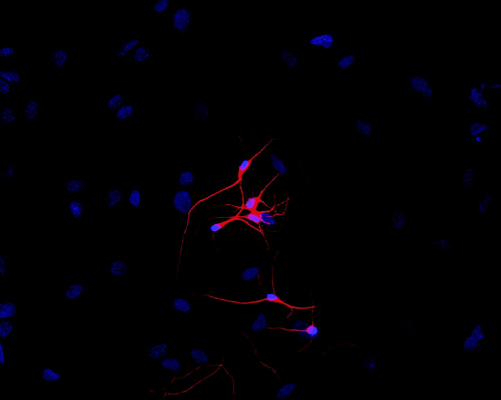 IHC-plus™ Monoclonal Mouse anti-Human TUBB3 / Tubulin Beta 3 Antibody (clone TU-20, C-Terminus, IHC, WB)