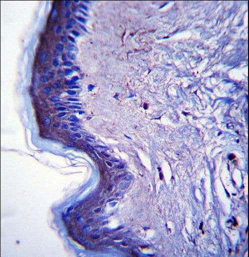 RHBDF2 Antibody (aa80-109)