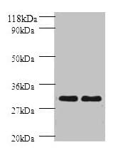 IHC-plus™ HLA-DPB1 Antibody