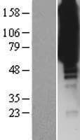 ISYNA1 Protein (Over-Expression Lysate Myc-DDK (Flag))