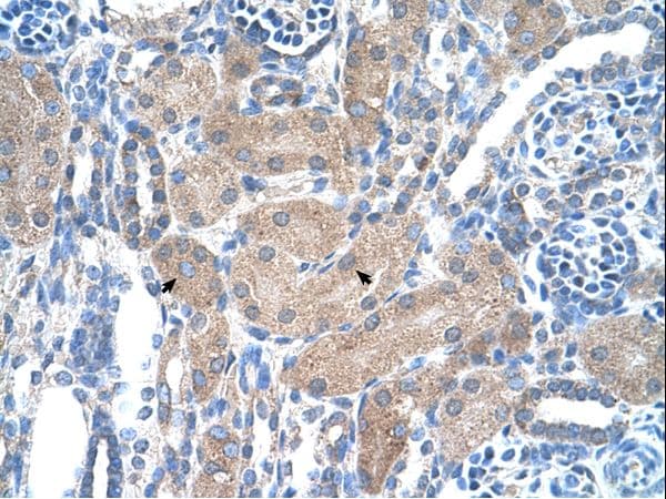 SEPSECS Antibody (aa61-110)