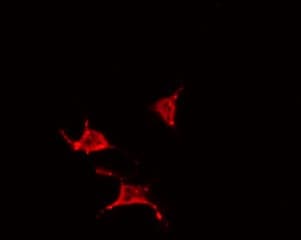 YTHDF1 Antibody