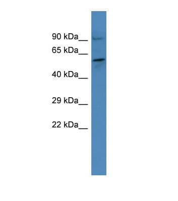 Polyclonal Rabbit anti-Human FSAP57 / SMU1 Antibody (aa100-149, WB)