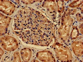 Polyclonal Rabbit anti-Human PDLIM2 / SLIM Antibody (IHC)