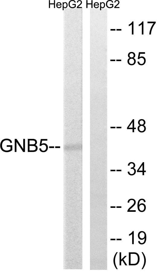 GB5 / GNB5 Antibody