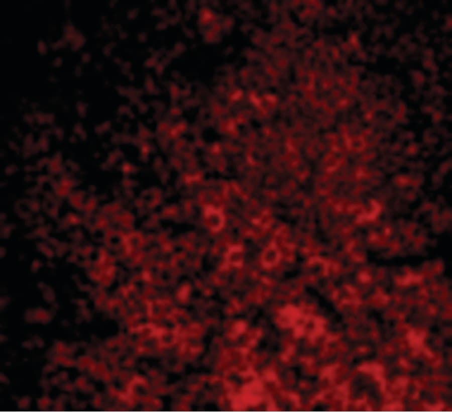 IHC-plus™ CARMA1 / CARD11 Antibody