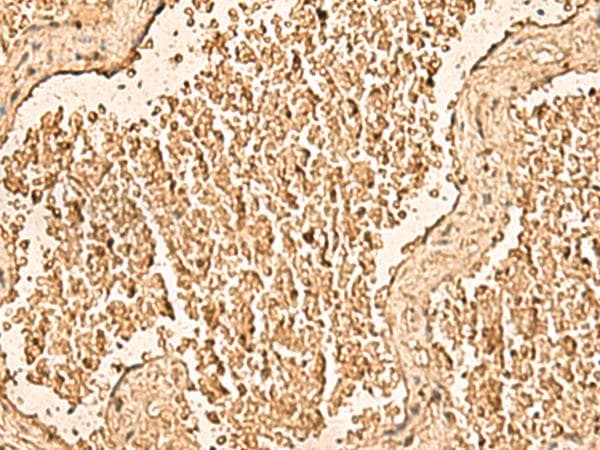 WDR33 Antibody