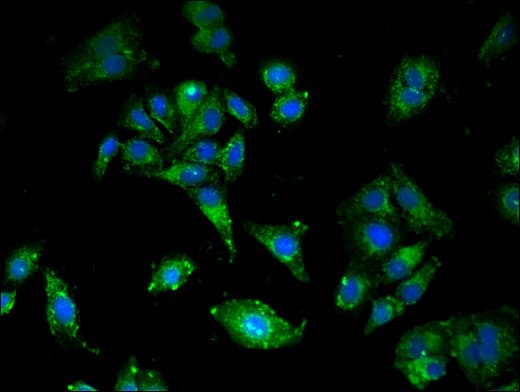 LDLR / LDL Receptor Antibody