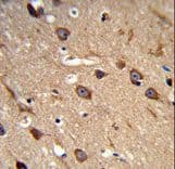 ASIC1 / ACCN2 Antibody (aa500-526)