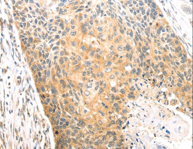 CAPN1 / Calpain 1 Antibody