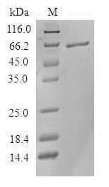 Human STRAP / MAWD Protein (Recombinant GST, N-terminus)