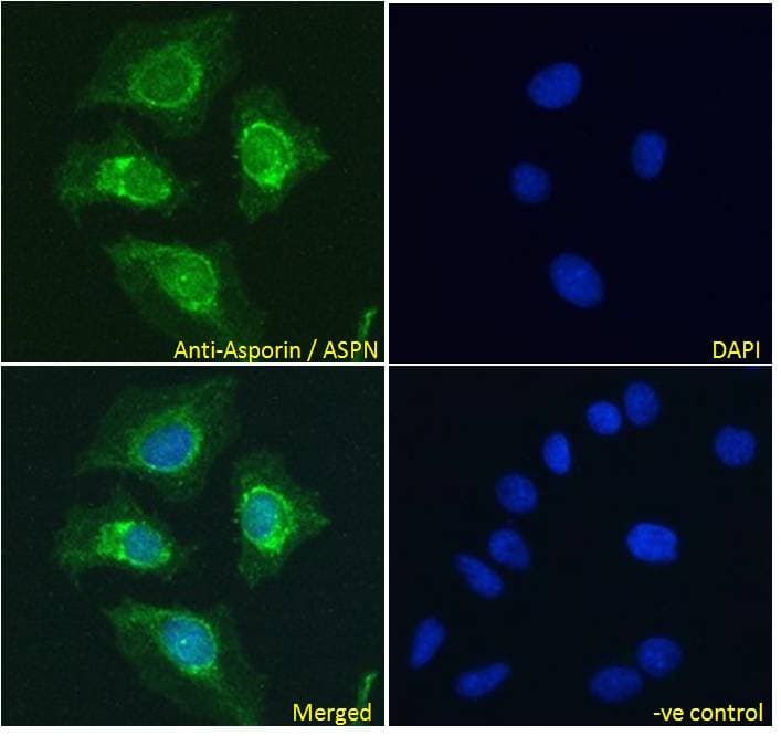 Polyclonal Goat anti-Human ASPN / Asporin Antibody (aa182-194, IF, WB)