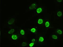 ACTN1 Antibody (clone OTI7A4)