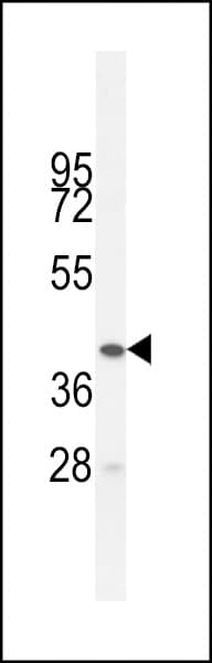 Polyclonal Rabbit anti-Human BTNL3 Antibody (aa427-455, WB)