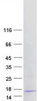 Human ABRACL Protein (Recombinant Myc-DDK (Flag))