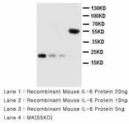 IL6 / Interleukin 6 Antibody (aa195-211, Magnetic beads)