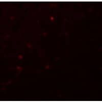 IKZF2 / HELIOS Antibody