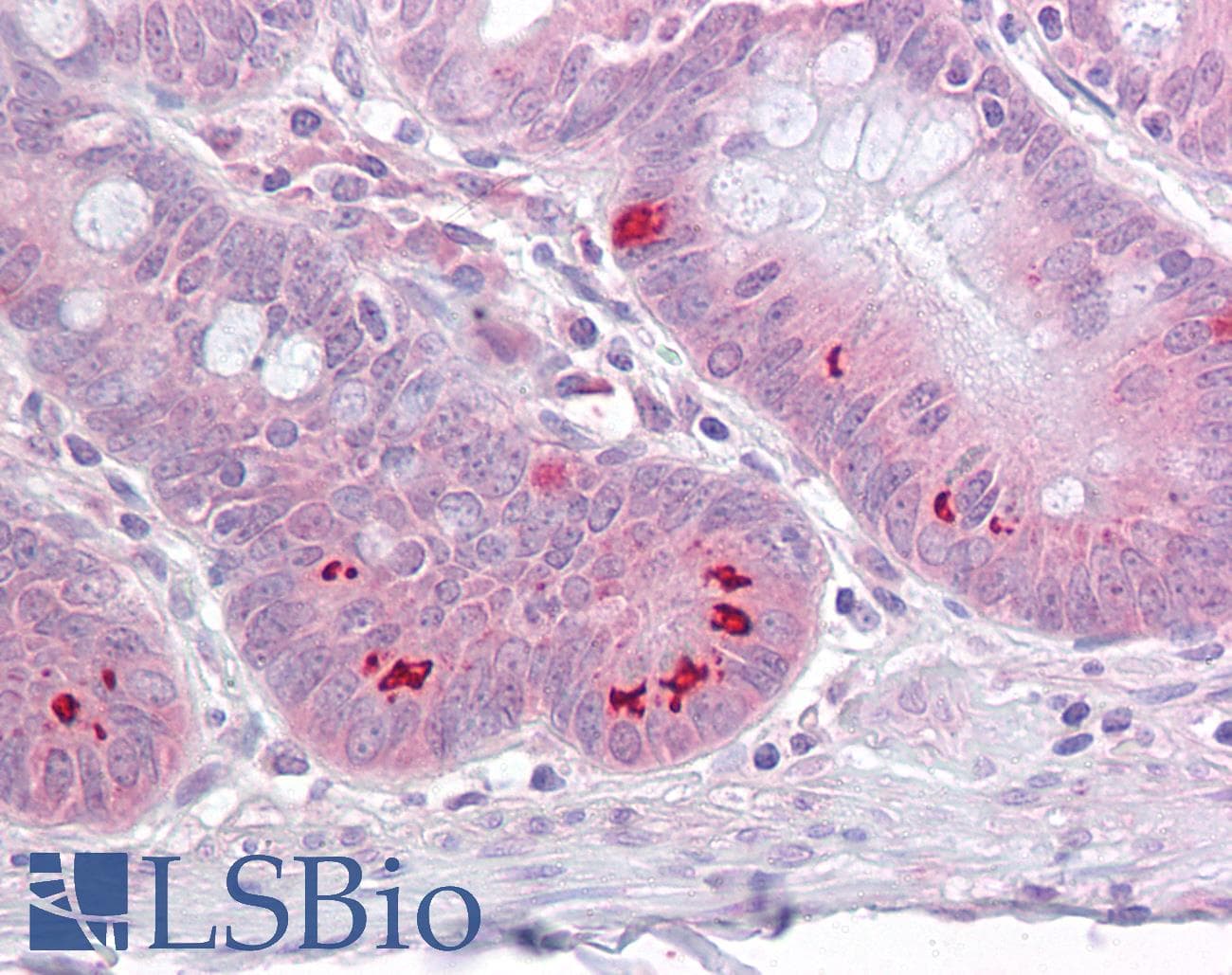 IHC-plus™ Polyclonal Rabbit anti-Human SETD7 / SET7 Antibody (aa131-145, IHC, WB)