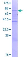 Human SMAP2 Protein (Recombinant GST)