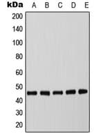 Polyclonal Rabbit anti-Human C/EBP Alpha / CEBPA Antibody (phospho-Thr226, WB)
