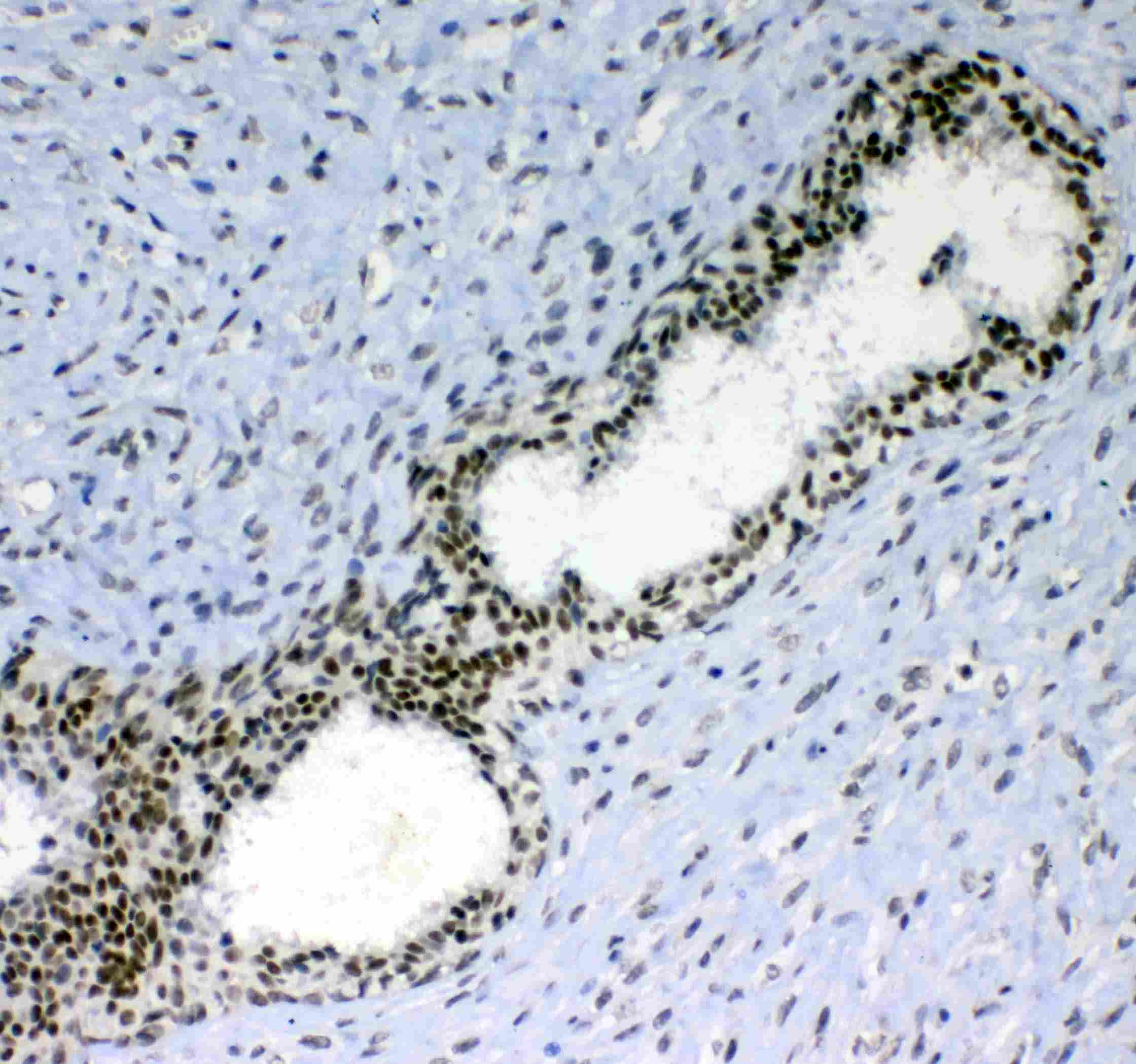 BLIMP1 / PRDM1 Antibody