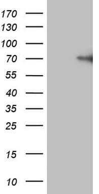 Monoclonal Mouse anti-Human F12 / Factor XII Antibody (clone OTI2D12, aa73-372, WB)